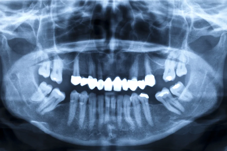 featured image