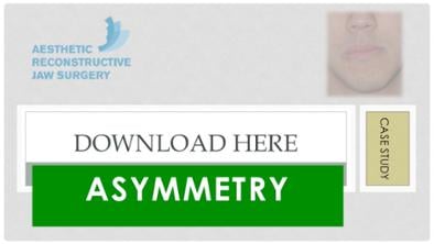 Jaw Asymmetry Case Study