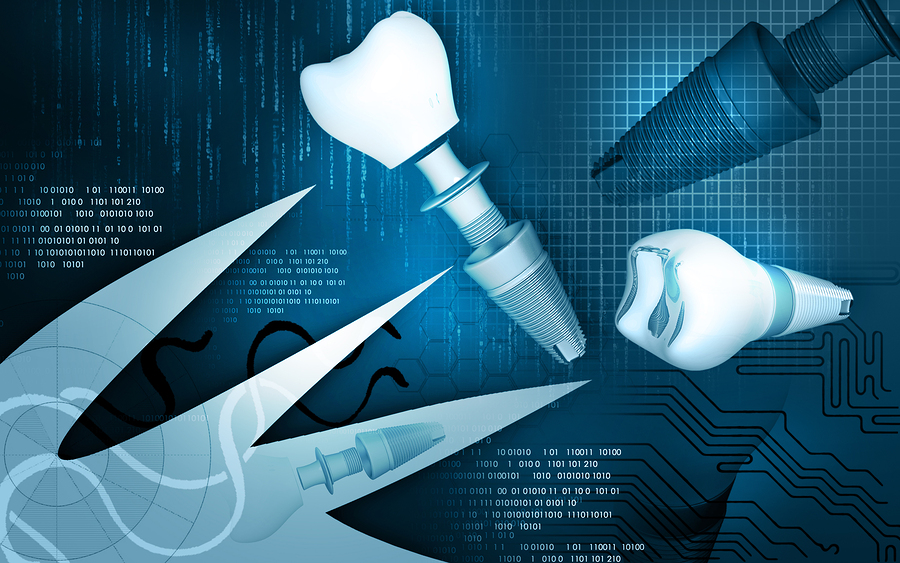 featured image