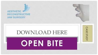 Case Study on Open Bite Corrective Surgery