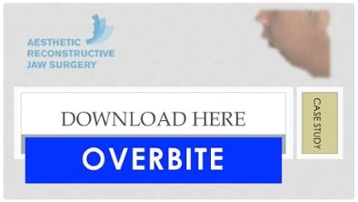 Case Study on Overbite