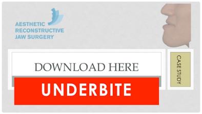 Case Study on Underbite Correction