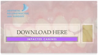 Impacted Canine Summary