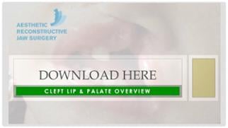 Cleft Lip & Palate Summary